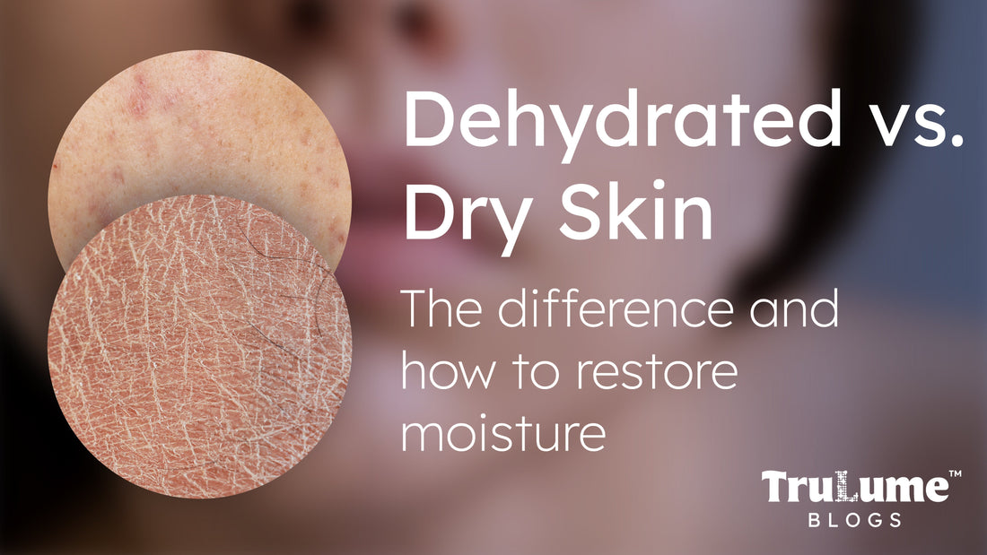 Dry vs Dehydrated Skin: Know the Difference