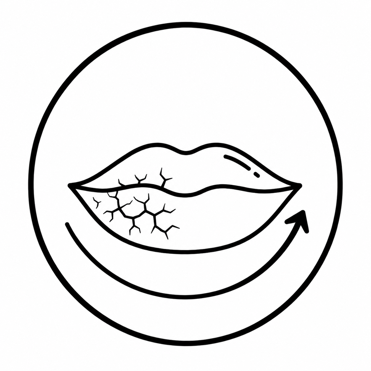 Chapped lips